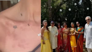 Priyanka Chopra’s ‘Bhabhi’, Neelam Faces Skin Allergy After&hellip;