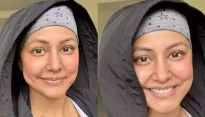 Hina Khan Reveals Why She Could Not EXPOSE Her Scalp As She Fought Stage Three Breast Cancer