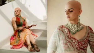 Mehendi Bride Flaunts Her Baldness Bravely, Dons A&hellip;