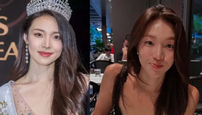 ‘Single’s Inferno 5’, Did Choi Mina Sue Undergo A Nose, Chin Along With Double Eyelid Surgery?