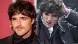 Did Jacob Elordi Suffer Second Degree Burns In&hellip;