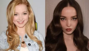 Did Dove Cameron Get Plastic Surgeries? Here’s Everything&hellip;