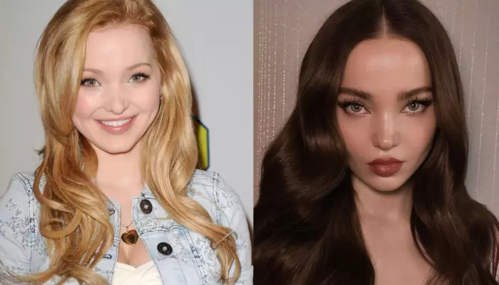 Did Dove Cameron Get Plastic…