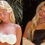 21-Yr-Old Influencer Spent USD 16K On Cosmetic Surgeries, From Lip Fillers To Breast Implants