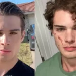 ‘Looksmaxxing’ 20-Yr-Old Influencer, Clavicular Speaks After Hospitalisation Due To Overdose