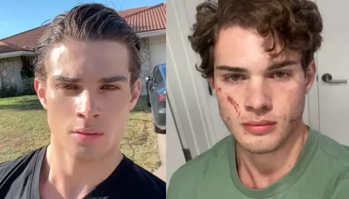 ‘Looksmaxxing’ 20-Yr-Old Influencer, Clavicular Speaks&hellip;