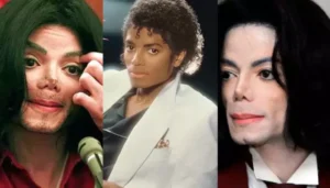 Michael Jackson’s Cosmetic Procedures, King Of Pop Underwent&hellip;