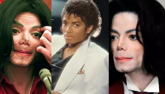 Michael Jackson’s Cosmetic Procedures, King Of Pop Underwent Scalp, Eyelid And 12 Nose Surgeries