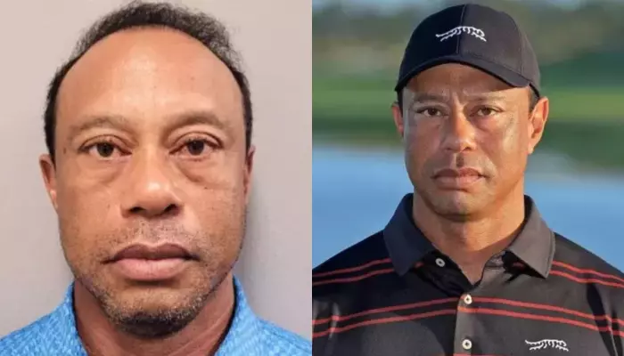 Golfer, Tiger Woods To Have His Treatment In Zurich, Amid Legal Troubles? Here’s What We Know