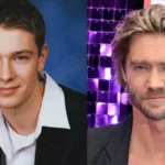 Chad Michael Murray’s Fans Remained Stunned With His Pics From Before Nose Injury Changed His Face