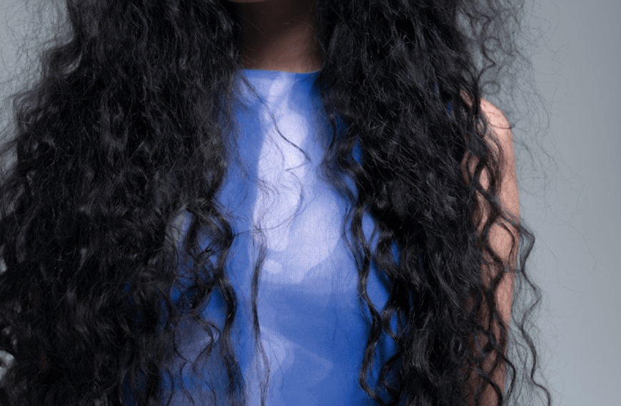 Can dandruff cause hair fall? Experts weigh in