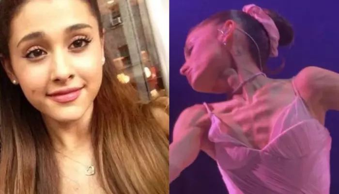 Ariana Grande’s Health Concern Grows After Her Eternal Sunshine Tour Act, ‘2x Thinner In Person’