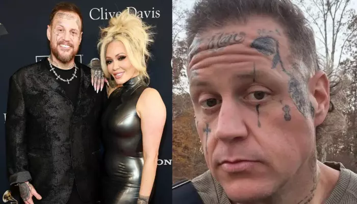 Why Did Jelly Roll Visit Hospital A Week Before His Divorce From Bunnie Xo? ‘I Was Puffy-Faced’