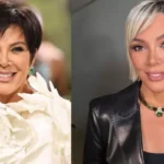 Kris Jenner’s Transformation With Plastic Surgeries, From Traditional Facelifts To Earlobe Reduction