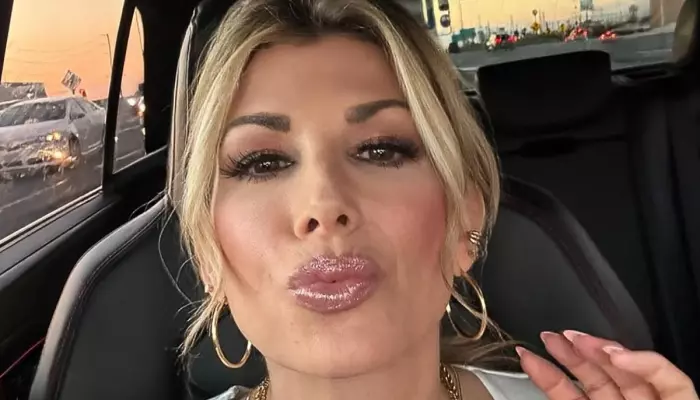 ‘Real Housewives’ Alexis Bellino Bought Herself A Facelift…