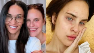 Demi Moore’s Daughter Tallulah Willis’ Before-And-After Face Filler&hellip;