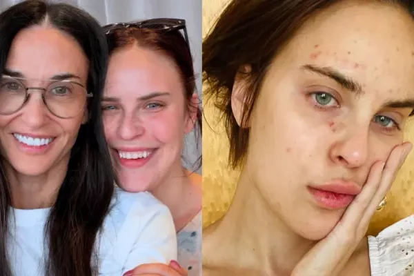 Demi Moore’s Daughter Tallulah Willis’ Before-And-After Face Filler&hellip;