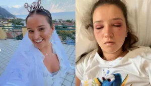 26-Year-Old Bride-To-Be ‘Almost Left Blind’ After USD 88&hellip;