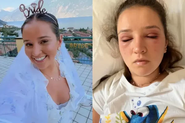 26-Year-Old Bride-To-Be ‘Almost Left Blind’ After USD 88…