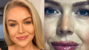 Karoline Leavitt’s Before-And-After Photos Track Her Transformation Amid&hellip;