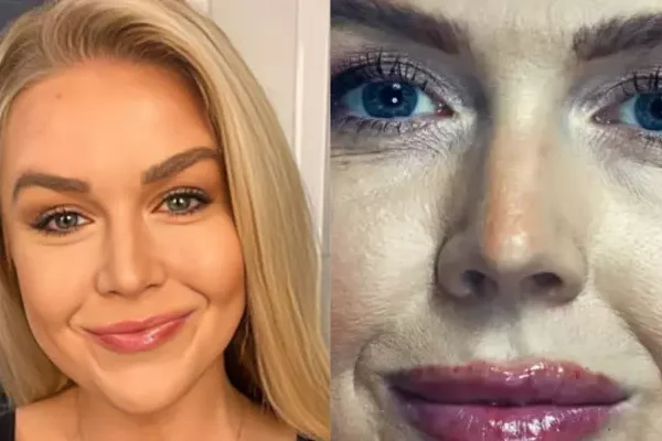 Karoline Leavitt’s Before-And-After Photos Track Her Transformation Amid&hellip;