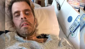 Perez Hilton’s Injuries From Bloody Live Are Far&hellip;