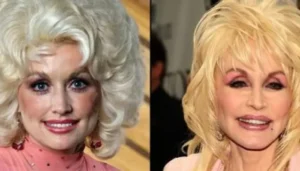 Dolly Parton Once Confessed To Undergoing Plastic Surgery,&hellip;