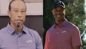 Tiger Woods Before And After Photo Surfaces As&hellip;