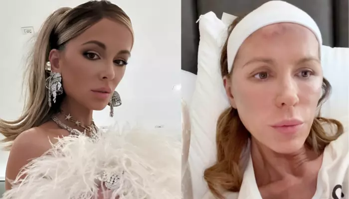Kate Beckinsale Gets Candid About Navigating PTSD After The Death Of Her Mom, ‘A Level Of Horror..’
