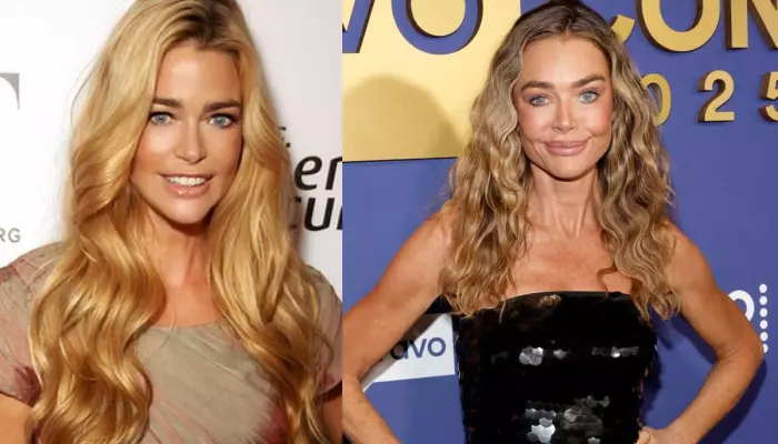 Denise Richards Was ‘Scared’ Of Facelift, Says Ex Aaron Tried To Leak Pics, Said ‘It’s Botched’