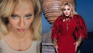 ‘Swelling From Surgeries…’, Madonna Boldly Reacted To Being&hellip;