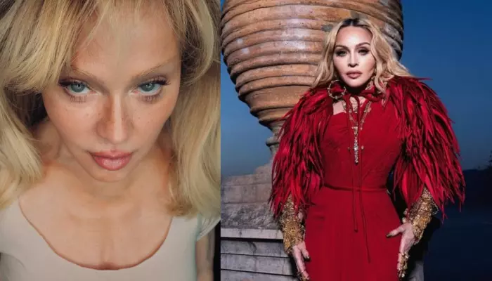 ‘Swelling From Surgeries…’, Madonna Boldly Reacted To Being Called ‘Unrecognizable’ At An Event