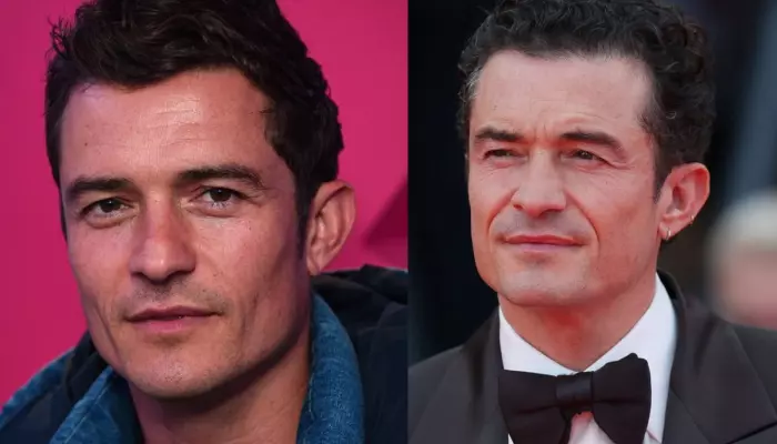 Orlando Bloom’s Shocking Transformation, Looks Drastically Different, Fans Claim He Has Aged