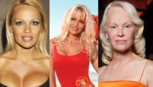 Pamela Anderson’s Dramatic Transformation, Had Multiple Breast Implants&hellip;